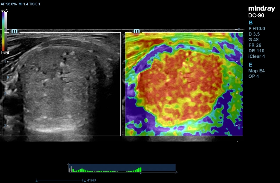 Mindray DC-90 X-insight