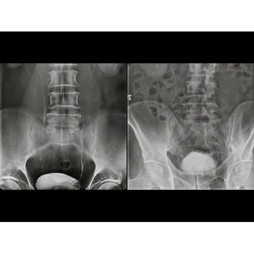 Рентген аппарат GE Discovery XR656