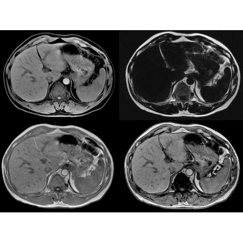 МРТ аппарат GE Optima MR450w 1.5T