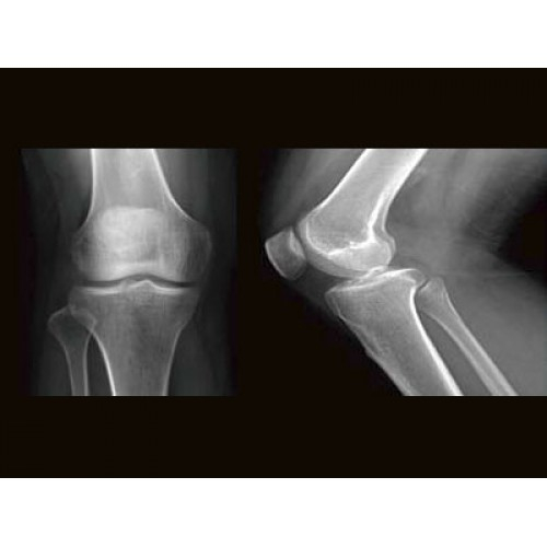 Цифровой рентген аппарат GE Brivo XR575